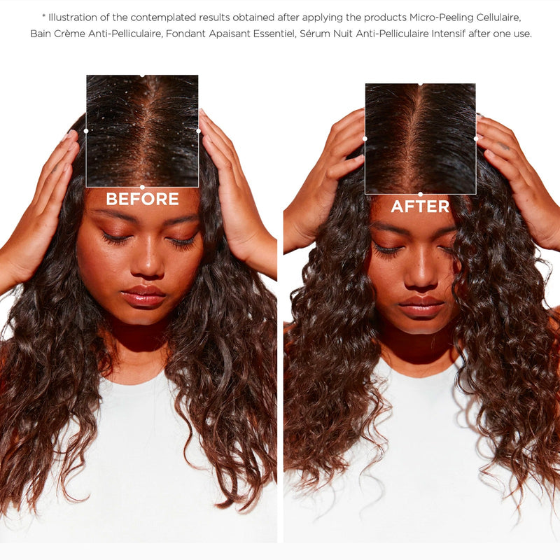 Kerastase Bain Creme Anti-Pelliculaire Shampoo 250ml -dayjour