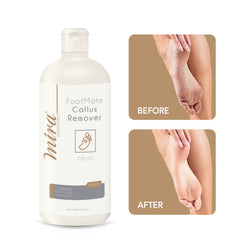 Mira FootMate Callus Remover 1000ml - dayjour - callus remover