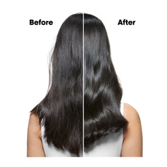 Loreal Professional SE Scalp Advanced Anti Dandruff Shampoo 1500ml