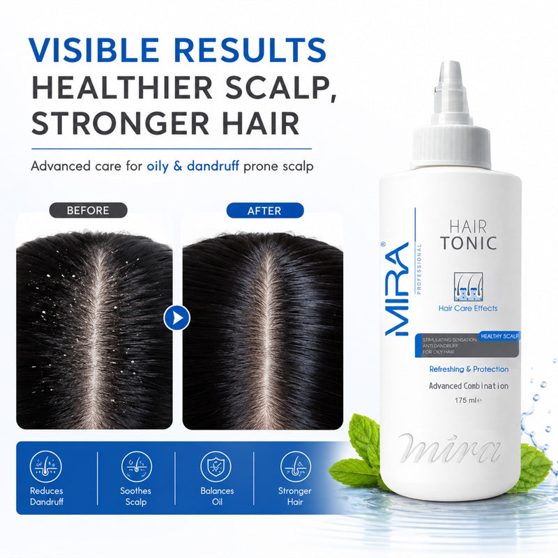 Mira Hair Tonic 175ml - anti dandruff hair tonic for oily hair - dayjour